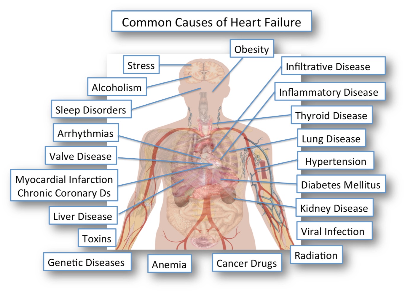 Can Iron In The Liver Cause Heart Failure CBUY